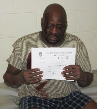 Floyd Dent, bloodied and seriously injured, in police cell. No medical attention was given for hours.