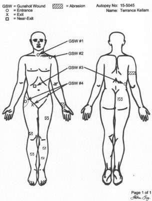 Terrance Kellom autopsy diagram shows he was shot in the back as family and attorney claimed.